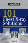 101 Chest X-Ray Solutions - Book