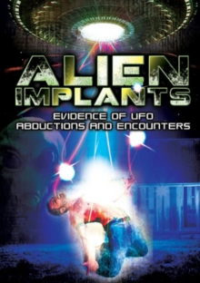 Alien Implants: Evidence of UFO Abductions and Encounters, DVD DVD Alien Implants: Evidence of UFO Abductions and Encounters, DVD DVD