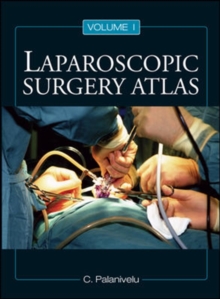 Laparoscopic Surgery Atlas, Hardback Book Laparoscopic Surgery Atlas, Hardback Book