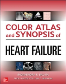 Color Atlas and Synopsis of Heart Failure, Paperback / softback Book Color Atlas and Synopsis of Heart Failure, Paperback / softback Book