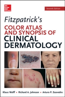 Fitzpatricks Color Atlas and Synopsis of Clinical Dermatology, Paperback Book Fitzpatricks Color Atlas and Synopsis of Clinical Dermatology, Paperback Book