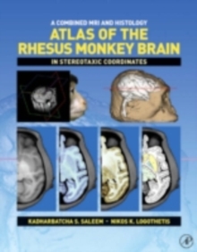 A Combined MRI and Histology Atlas of the Rhesus Monkey Brain in Stereotaxic Coordinates