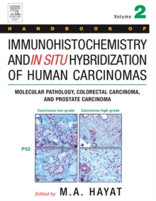 Handbook of Immunohistochemistry and in Situ Hybridization of Human Carcinomas : Molecular Pathology, Colorectal Carcinoma, and Prostate Carcinoma