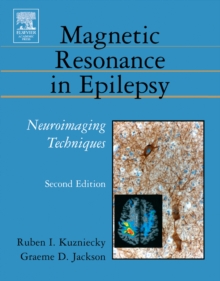 Magnetic Resonance in Epilepsy : Neuroimaging Techniques, Second Edition