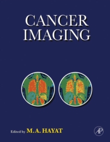 Cancer Imaging : Instrumentation and Applications