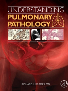 Understanding Pulmonary Pathology : Applying Pathological Findings in Therapeutic Decision Making, Paperback / softback Book Understanding Pulmonary Pathology : Applying Pathological Findings in Therapeutic Decision Making, Paperback / softback Book