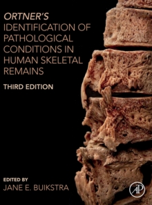 Ortner's Identification of Pathological Conditions in Human Skeletal Remains