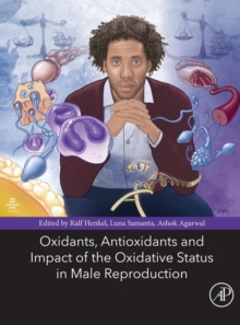 Oxidants, Antioxidants, and Impact of the Oxidative Status in Male Reproduction, Paperback / softback Book Oxidants, Antioxidants, and Impact of the Oxidative Status in Male Reproduction, Paperback / softback Book