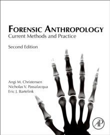 Forensic Anthropology : Current Methods and Practice