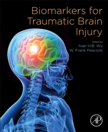 Biomarkers for Traumatic Brain Injury, Paperback / softback Book Biomarkers for Traumatic Brain Injury, Paperback / softback Book