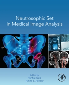 Neutrosophic Set in Medical Image Analysis, Paperback / softback Book Neutrosophic Set in Medical Image Analysis, Paperback / softback Book