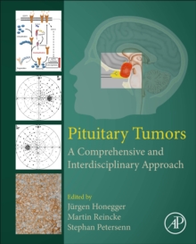 Pituitary Tumors : A Comprehensive and Interdisciplinary Approach