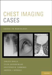 Chest Imaging Cases