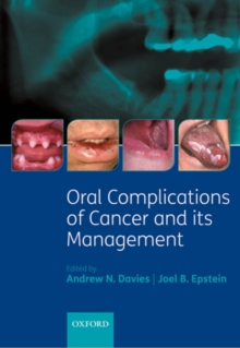 Oral Complications of Cancer and its Management