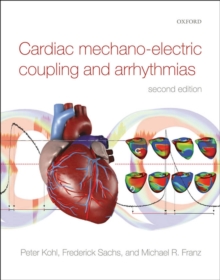 Cardiac Mechano-Electric Coupling and Arrhythmias