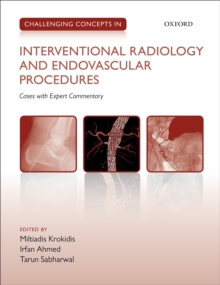 Challenging Concepts in Interventional Radiology