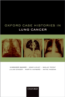 Oxford Case Histories in Lung Cancer