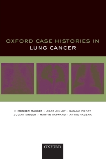 Oxford Case Histories in Lung Cancer, Paperback / softback Book Oxford Case Histories in Lung Cancer, Paperback / softback Book
