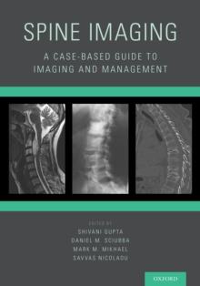 Spine Imaging : A Case-Based Guide to Imaging and Management