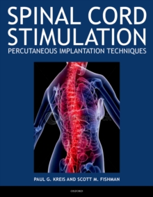 Spinal Cord Stimulation : Percutaneous Implantation Techniques