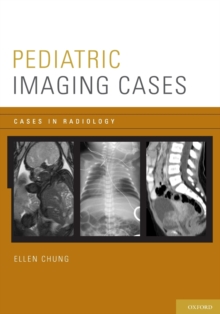 Pediatric Imaging Cases, Paperback / softback Book Pediatric Imaging Cases, Paperback / softback Book