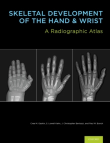 Skeletal Development of the Hand and Wrist : A Radiographic Atlas and Digital Bone Age Companion