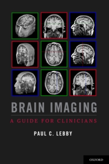 Brain Imaging : A Guide for Clinicians