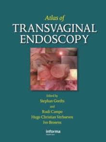 Atlas of Transvaginal Endoscopy