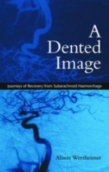 A Dented Image : Journeys of Recovery from Subarachnoid Haemorrhage