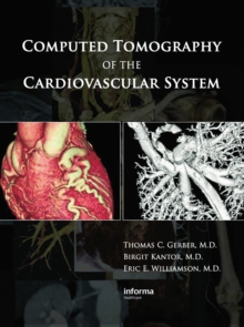 Computed Tomography of the Cardiovascular System