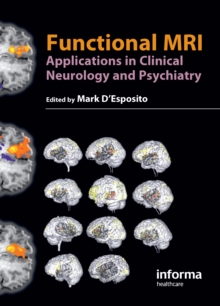 Functional MRI : Applications in Clinical Neurology and Psychiatry