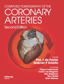 Computed Tomography of the Coronary Arteries