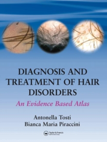 Diagnosis and Treatment of Hair Disorders : An Evidence-Based Atlas