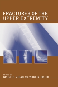 Fractures of the Upper Extremity