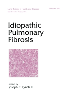 Idiopathic Pulmonary Fibrosis