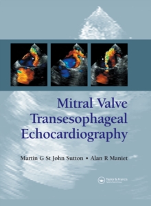 Mitral Valve Transesophageal Echocardiography