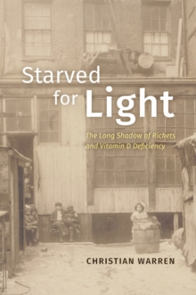 Starved for Light : The Long Shadow of Rickets and Vitamin D Deficiency