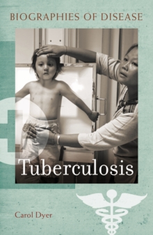 Tuberculosis