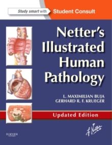 Netter's Illustrated Human Pathology Updated Edition : with Student Consult Access