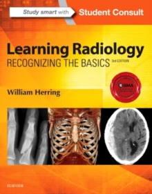 Learning Radiology : Recognizing the Basics, Paperback Book Learning Radiology : Recognizing the Basics, Paperback Book