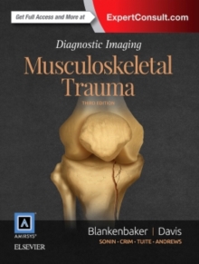 Diagnostic Imaging: Musculoskeletal Trauma, Hardback Book Diagnostic Imaging: Musculoskeletal Trauma, Hardback Book