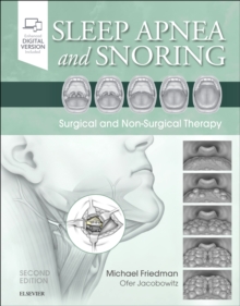 Sleep Apnea and Snoring : Surgical and Non-Surgical Therapy, Hardback Book Sleep Apnea and Snoring : Surgical and Non-Surgical Therapy, Hardback Book