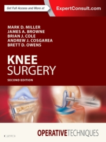 Operative Techniques: Knee Surgery, Hardback Book Operative Techniques: Knee Surgery, Hardback Book