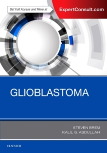 Glioblastoma, Hardback Book Glioblastoma, Hardback Book