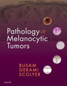 Pathology of Melanocytic Tumors E-Book