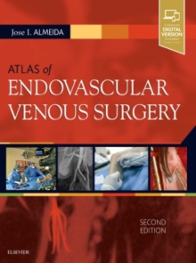 Atlas of Endovascular Venous Surgery, Hardback Book Atlas of Endovascular Venous Surgery, Hardback Book
