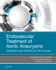 Endovascular Treatment of Aortic Aneurysms : Standard and Advanced Techniques