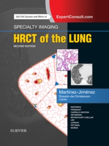 Specialty Imaging: HRCT of the Lung E-Book : Specialty Imaging: HRCT of the Lung E-Book