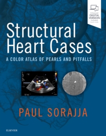 Structural Heart Cases E-Book : A Color Atlas of Pearls and Pitfalls