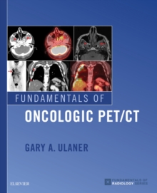 Fundamentals of Oncologic PET/CT E-Book